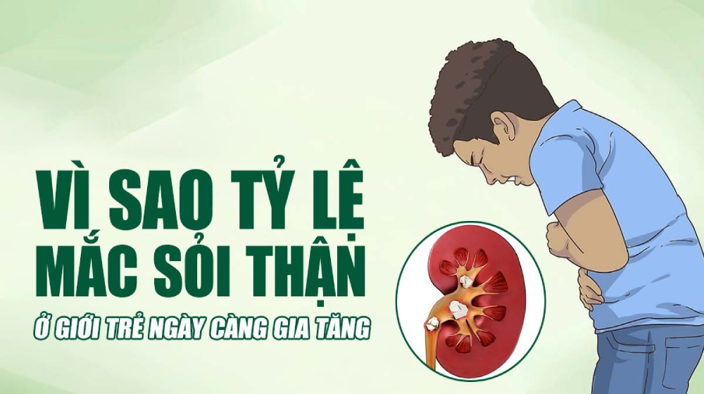 Sỏi thận ở giới trẻ: Khi deadline quan trọng hơn sức khỏe