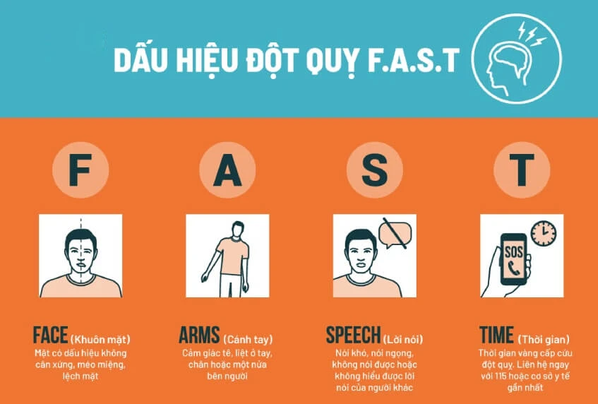 Phương pháp F.A.S.T